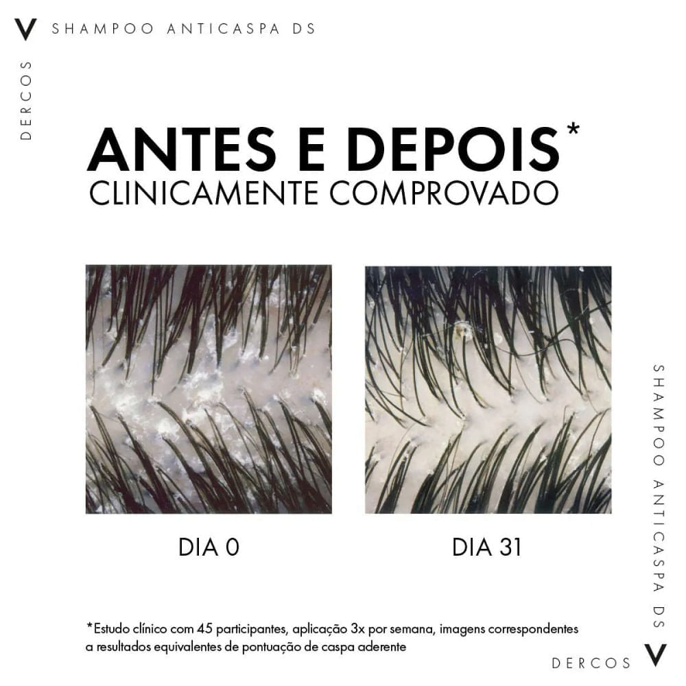 Refil Shampoo Anticaspa DS Vichy Dercos Dry Cabelos Secos 200g